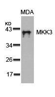 Western blot analysis of extracts from MDA cells using MKK3(Ab-189) Antibody. Western blot analysis of extracts from MDA cells using MKK3(Ab-189) Antibody.