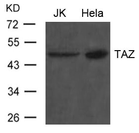 Western blot analysis of extract from JK and Hela cells using TAZ Antibody Western blot analysis of extract from JK and Hela cells using TAZ Antibody