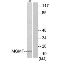 Western blot analysis of extracts from Jurkat cells, using MGMT antibody. Western blot analysis of extracts from Jurkat cells, using MGMT antibody.