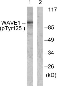 Western blot analysis of extracts from NIH/3T3 cells, treated with Insulin (0.01U/ml, 15mins), using WAVE1 (Phospho-Tyr125) antibody. The lane on the right is treated with the synthesized peptide. Western blot analysis of extracts from NIH/3T3 cells, treated with Insulin (0.01U/ml, 15mins), using WAVE1 (Phospho-Tyr125) antibody. The lane on the right is treated with the synthesized peptide.