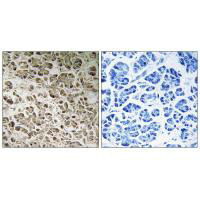 Immunohistochemistry analysis of paraffin-embedded human pancreas tissue using NDUFB1 antibody. Immunohistochemistry analysis of paraffin-embedded human pancreas tissue using NDUFB1 antibody.