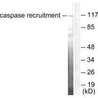 Western blot analysis of extracts from HeLa cells, using CARD6 antibody. Western blot analysis of extracts from HeLa cells, using CARD6 antibody.