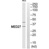Western blot analysis of extracts from HeLa cells, using MED27 antibody.