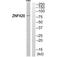 Western blot analysis of extracts from K562 cells, using ZNF420 antibody. Western blot analysis of extracts from K562 cells, using ZNF420 antibody.