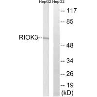Western blot analysis of extracts from HepG2 cells, using RIOK3 antibody.