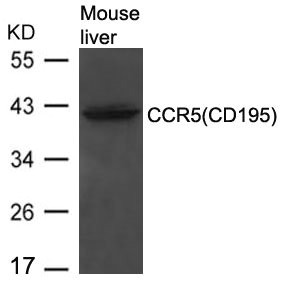 Western blot analysis of extracts from Mouse liver tissue using CCR5(CD195) Antibody. Western blot analysis of extracts from Mouse liver tissue using CCR5(CD195) Antibody.