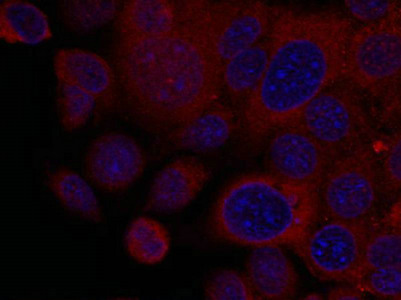 Immunofluorescence staining of methanol-fixed MCF7 cells using p70 S6 Kinase(Ab-411) Antibody.