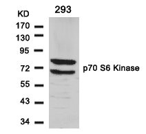Western blot analysis of extracts from 293 cells using p70 S6 Kinase(Ab-411) Antibody. Western blot analysis of extracts from 293 cells using p70 S6 Kinase(Ab-411) Antibody.