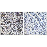 Immunohistochemistry analysis of paraffin-embedded human tonsil tissue, using STK17B antibody.