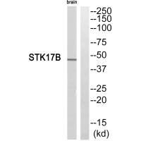 Western blot analysis of extracts from mouse brain cells, using STK17B antibody. Western blot analysis of extracts from mouse brain cells, using STK17B antibody.
