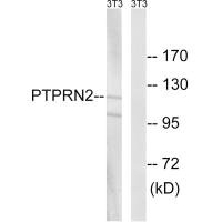 Western blot analysis of extracts from NIH/3T3 cells, using PTPRN2 antibody. Western blot analysis of extracts from NIH/3T3 cells, using PTPRN2 antibody.