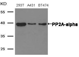 Western blot analysis of extracts from 293T,A431 and BT474 cells using PP2A-alpha antibody.