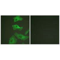 Immunofluorescence analysis of HeLa cells, treated with TNF-a (20nM, 15mins), using HSP90B (Ab-254) antibody.