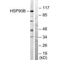 Western blot analysis of extracts from Hela cells treated with TNF-alpha (20ng/ml, 30min), using HSP90B (Ab-254) antibody.