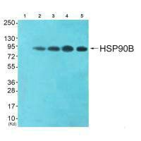 Western blot analysis of extracts from HeLa cells (Lane 2), CoLo cells (Lane 3), HepG2 cells (Lane 4) and 293 cells (Lane 5), using HSP90B (Ab-254) antiobdy. The lane on the left is treated with synthesized peptide.