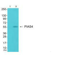 Western blot analysis of extracts from JK cells (Lane 2), using PIAS4 antiobdy. The lane on the left is treated with synthesized peptide.