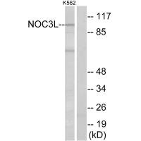 Western blot analysis of extracts from K562 cells, using NOC3L antibody. Western blot analysis of extracts from K562 cells, using NOC3L antibody.