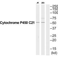 Western blot analysis of extracts from Jurkat/293 cells, using CYP21A2 antibody. Western blot analysis of extracts from Jurkat/293 cells, using CYP21A2 antibody.
