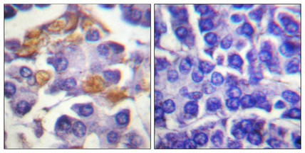 Immunohistochemical analysis of paraffin-embedded human pancreas tissue using Raf1 (Phospho-Tyr341) antibody (left)or the same antibody preincubated with blocking peptide (right).