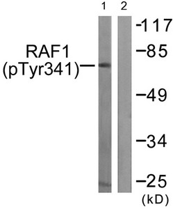 Western blot analysis of extracts from Jurkat cells treated with Paclitaxel using Raf1 (Phospho-Tyr341) Antibody.The lane on the right is treated with the antigen-specific peptide. Western blot analysis of extracts from Jurkat cells treated with Paclitaxel using Raf1 (Phospho-Tyr341) Antibody.The lane on the right is treated with the antigen-specific peptide.
