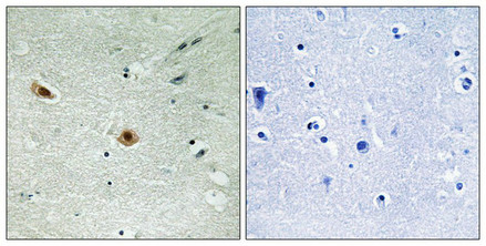 Immunohistochemical analysis of paraffin-embedded human brain tissue using Retinoblastoma (Phospho-Ser608) antibody (left)or the same antibody preincubated with blocking peptide (right).