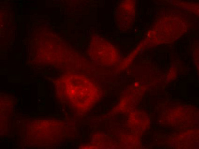 Immunofluorescence staining of methanol-fixed Hela cells using PAK1/PAK2/PAK3(Ab-423/402/421) Antibody.