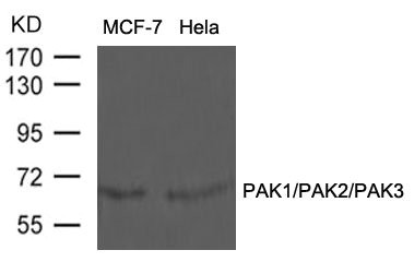 Western blot analysis of extracts from MCF-7 and Hela cells using PAK1/PAK2/PAK3(Ab-423/402/421) Antibody. Western blot analysis of extracts from MCF-7 and Hela cells using PAK1/PAK2/PAK3(Ab-423/402/421) Antibody.