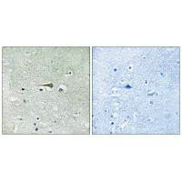Immunohistochemistry analysis of paraffin-embedded human brain tissue using TTK (Ab-676) antibody. Immunohistochemistry analysis of paraffin-embedded human brain tissue using TTK (Ab-676) antibody.