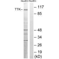 Western blot analysis of extracts from HUVEC cells, treated with etoposide (25uM, 24hours), using TTK (Ab-676) antibody.