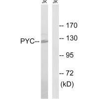 Western blot analysis of extracts from Jurkat cells, using PC antibody. Western blot analysis of extracts from Jurkat cells, using PC antibody.
