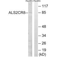 Western blot analysis of extracts from HuvEc cells, using ALS2CR8 antibody. Western blot analysis of extracts from HuvEc cells, using ALS2CR8 antibody.