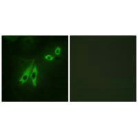 Immunofluorescence analysis of NIH/3T3 cells, using AKAP3 antibody. Immunofluorescence analysis of NIH/3T3 cells, using AKAP3 antibody.