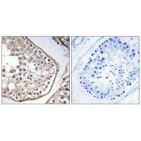 Immunohistochemistry analysis of paraffin-embedded human testis tissue using BAGE3 antibody. Immunohistochemistry analysis of paraffin-embedded human testis tissue using BAGE3 antibody.