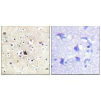 Immunohistochemical analysis of paraffin-embedded human brain tissue using GR (Ab-226) antibody. Immunohistochemical analysis of paraffin-embedded human brain tissue using GR (Ab-226) antibody.