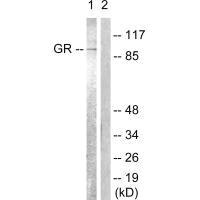 Western blot analysis of extracts from Jurkat cells, treated with EGF (200ng/ml, 15mins), using GR (Ab-226) antibody.