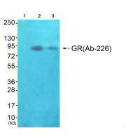 Western blot analysis of extracts from JK cells (Lane 2) and K562 cells (Lane 3), using GR(Ab-226) antiobdy. The lane on the left is treated with synthesized peptide.