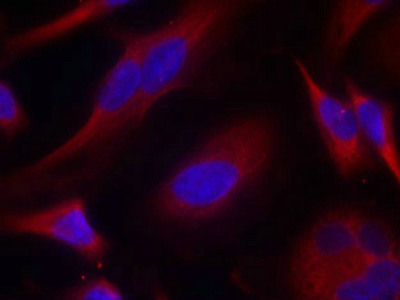 Immunofluorescence staining of methanol-fixed Hela cells using PKD/PKCm(Ab-738) Antibody.