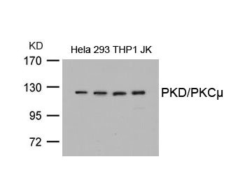Western blot analysis of extracts from Hela, 293, THP1 and JK cells using PKD/PKCm(Ab-738) Antibody. Western blot analysis of extracts from Hela, 293, THP1 and JK cells using PKD/PKCm(Ab-738) Antibody.