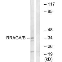 Western blot analysis of extracts from HepG2 cells, using RRAGA/B antibody. Western blot analysis of extracts from HepG2 cells, using RRAGA/B antibody.