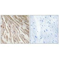 Immunohistochemistry analysis of paraffin-embedded human heart tissue, using ARPP21 antibody.