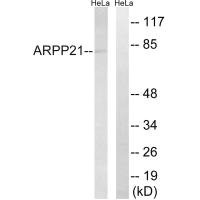 Western blot analysis of extracts from HeLa cells, using ARPP21 antibody. Western blot analysis of extracts from HeLa cells, using ARPP21 antibody.