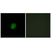 Immunofluorescence analysis of HepG2 cells, using ARMX2 antibody.