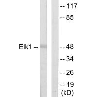 Western blot analysis of extracts from HeLa cells, using Elk1 antibody. Western blot analysis of extracts from HeLa cells, using Elk1 antibody.