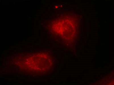 Immunofluorescence staining of methanol-fixed Hela cells using IkB-a(Ab-32/36) Antibody.