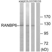 Western blot analysis of extracts from K562 cells, COLO cells and COS-7 cells, using RANBP6 antibody. Western blot analysis of extracts from K562 cells, COLO cells and COS-7 cells, using RANBP6 antibody.