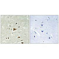 Immunohistochemistry analysis of paraffin-embedded human brain tissue using Smad2 (Ab-220) antiobdy.