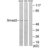 Western blot analysis of extracts from RAW264.7 cells and 293 cells, using Smad2 (Ab-220) antibody. Western blot analysis of extracts from RAW264.7 cells and 293 cells, using Smad2 (Ab-220) antibody.