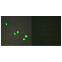 Immunofluorescence analysis of HepG2 cells, using CHD4 antibody.