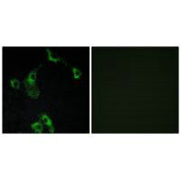Immunofluorescence analysis of COS-7 cells, using CIDEB antibody.