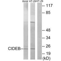 Western blot analysis of extracts from RAW264.7 cells and HT-29 cells, using CIDEB antibody. Western blot analysis of extracts from RAW264.7 cells and HT-29 cells, using CIDEB antibody.